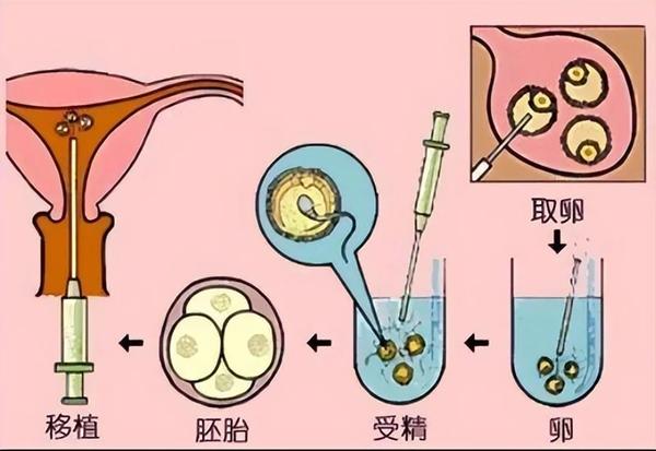 女性做借卵试管会为身体带来哪些危害？