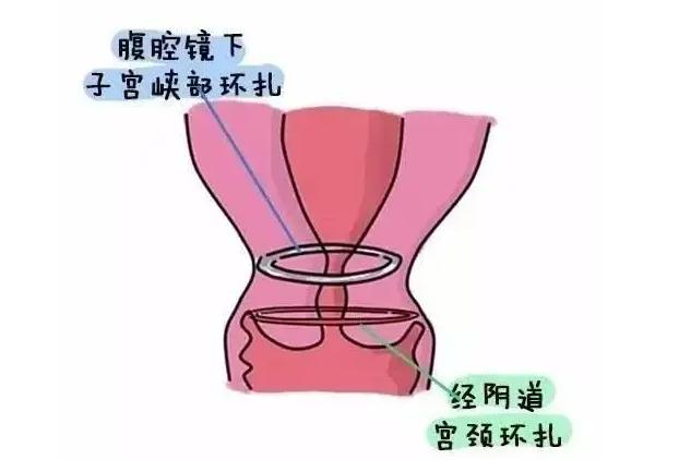 十八岁姑娘月经不正常怎么回事？