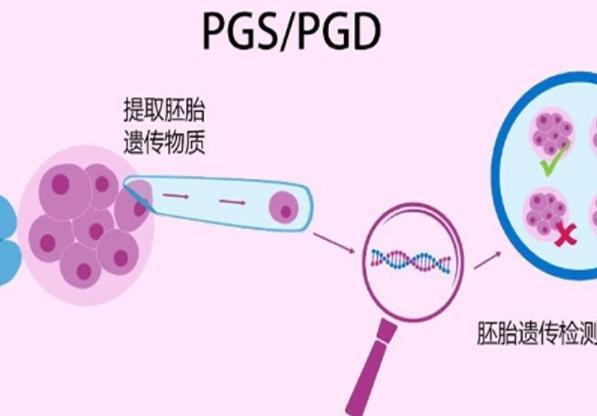 年龄比较大的患者做试管，应该选择短方案促排吗?