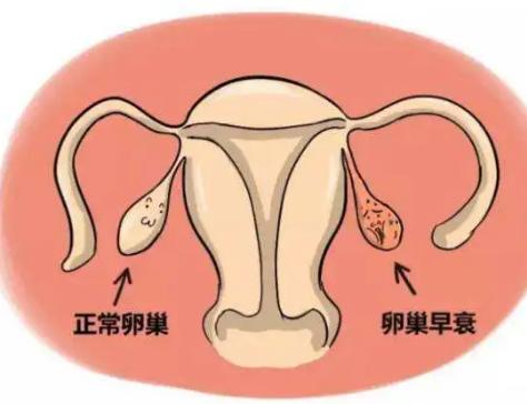 47岁卵巢早衰患者做试管婴儿的成功率高吗？