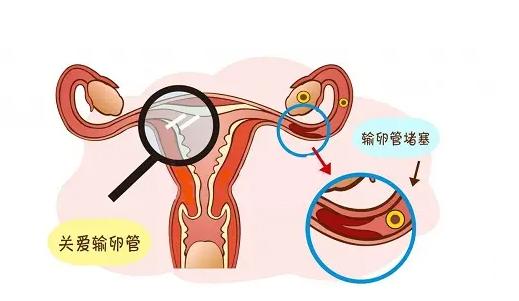 流产后月经量少，想怀孕怎么调理？