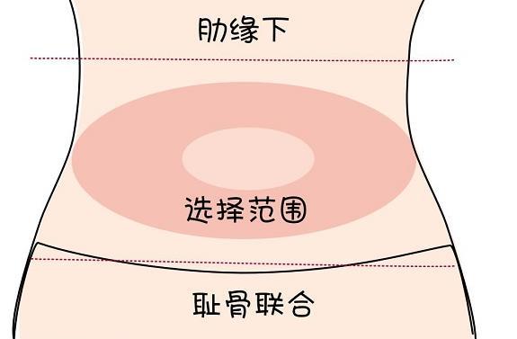 注射贝依针期间，需要采取避孕措施吗？