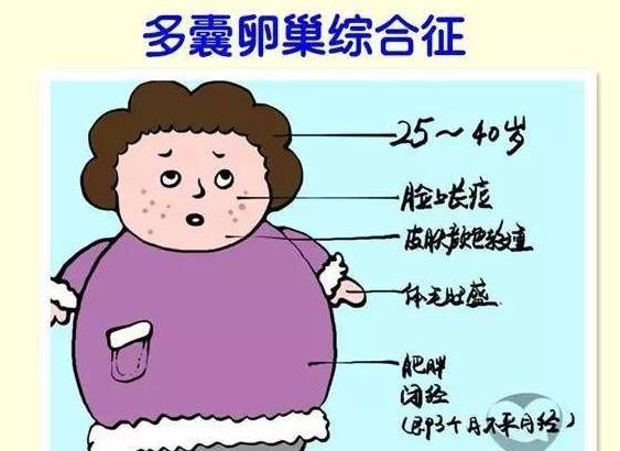 女性患有多囊卵巢综合症，可以同房吗？