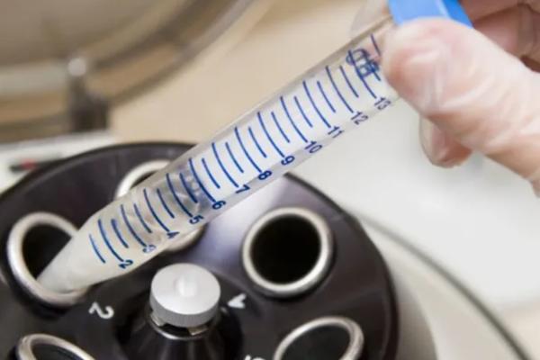 试管婴儿精子注射icsi助孕是哪代试管技术？适用于哪些人？