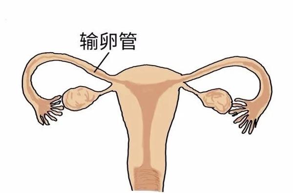 女性输卵管一侧切除了还可以做试管婴儿吗？