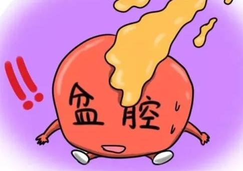 盆腔炎用什么办法治疗能彻底治愈？