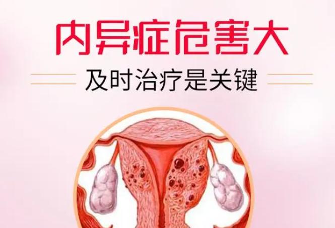 ​贝依治疗子宫内膜异位症，可以治愈好吗？