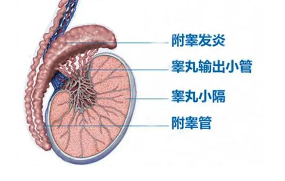 沈阳附睾炎做试管婴儿的费用预算多少才够？