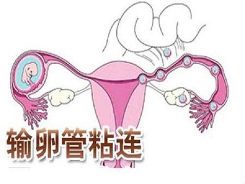 宫腔粘连内膜薄做一次供卵试管婴儿大概要多少钱？