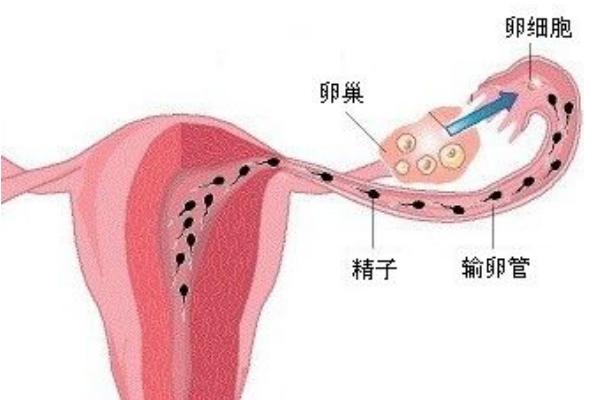 轻度输卵管炎可以先调理之后在进行试管婴儿吗？