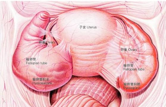 单侧输卵管炎做三代试管可以怀双胞胎吗大概多少钱？