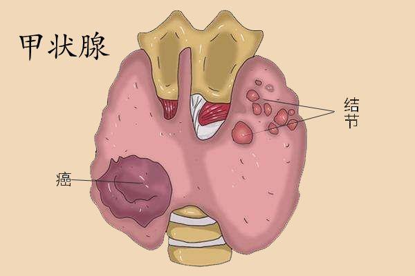 甲状腺功能减退在江苏省人民医院能做试管婴儿吗？