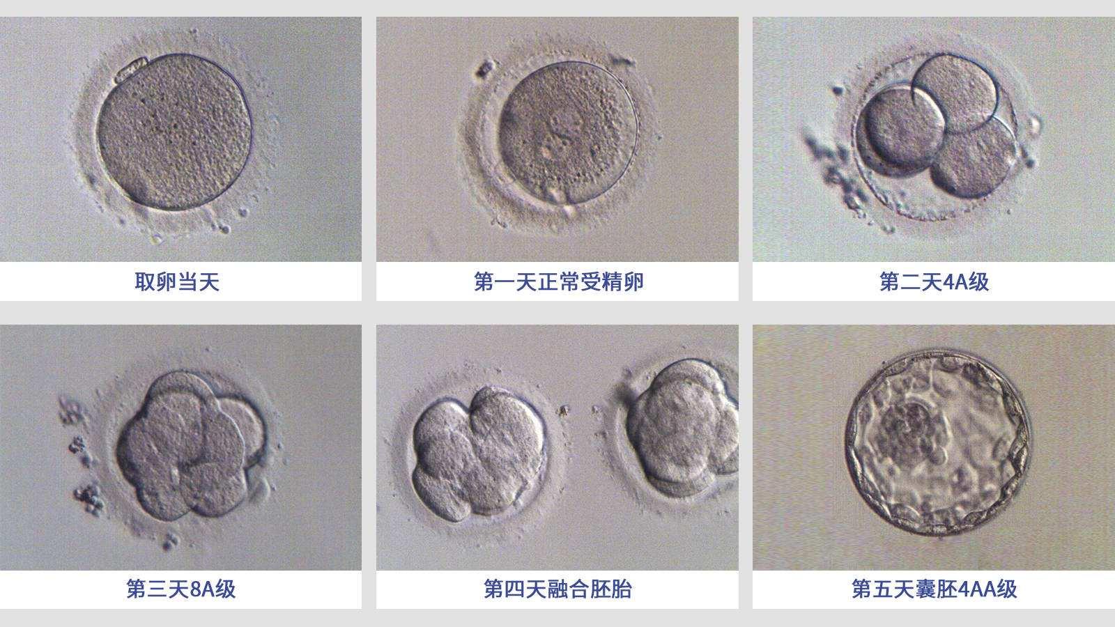 囊胚移植后每天都在变化，来看看神奇的过程