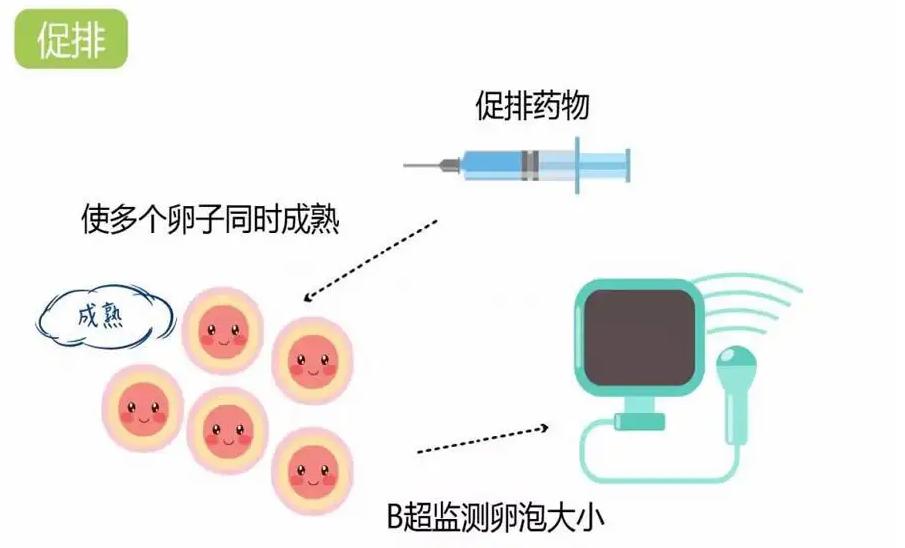 详述不同促排方案对卵子质量高低的影响