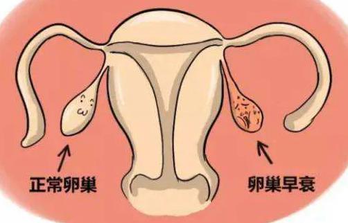 如何护理卵巢预防卵巢功能下降的情况呢？