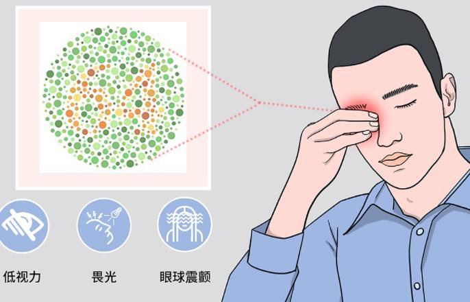 色盲携带者允许做第三代试管吗？有遗传问题即可进行