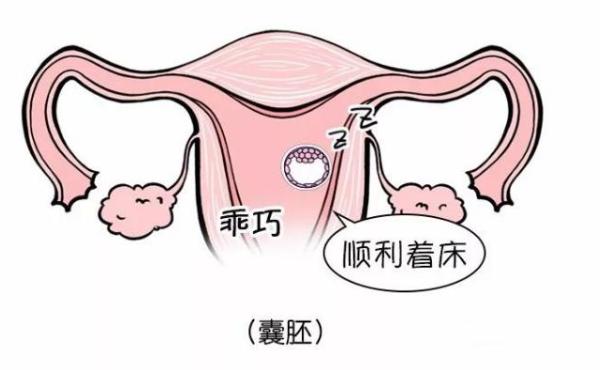 输卵管通液后多久可以怀孕？医生：具体时间取决于个人