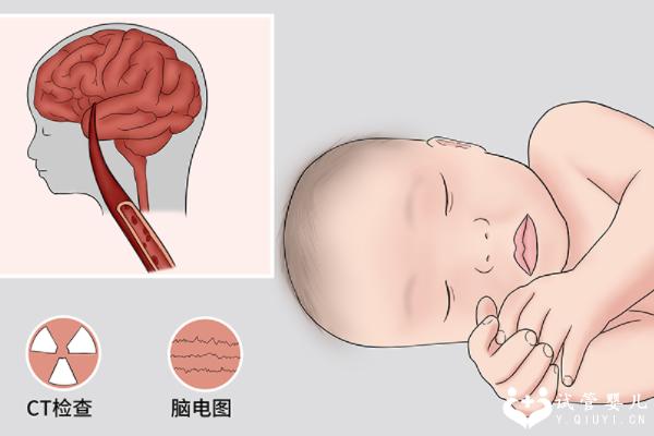 深入解析新生儿颅内缺氧出血原因，每位家长都应重视