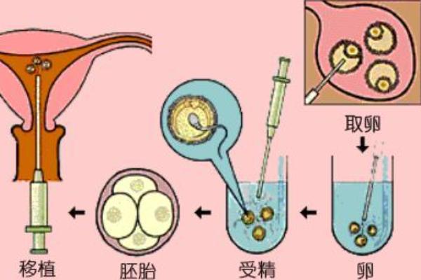 泰国试管自助行，自助试管攻略