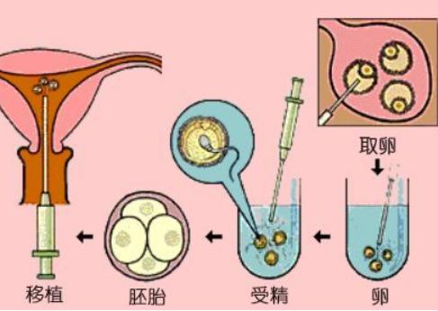 杭州试管医院攻略来了，2023想助孕的杭州女性不要错过！