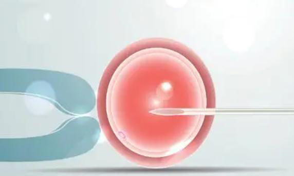 试管鲜胚移植一般是什么人群去做的？